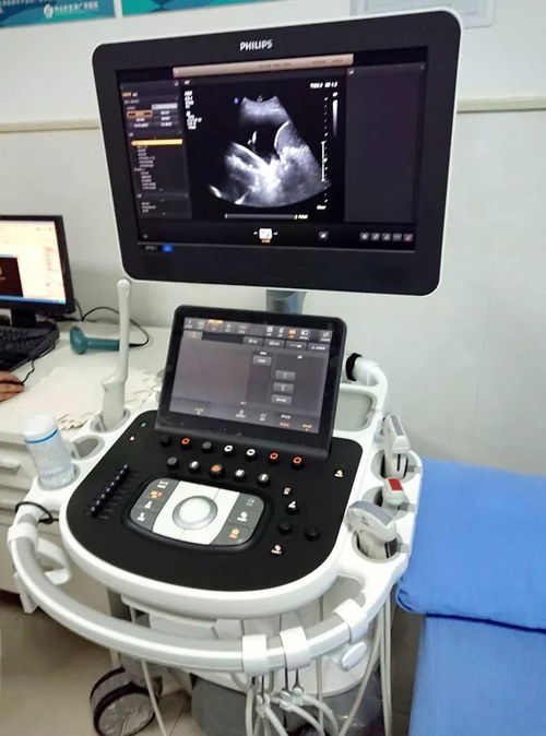 超聲檢查再添利器，來(lái)廣華體驗(yàn)國(guó)際高端彩超設(shè)備