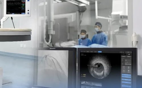 上半年45個(gè)創(chuàng)新醫(yī)療器械獲批，國(guó)產(chǎn)超聲設(shè)備向高端化邁進(jìn)